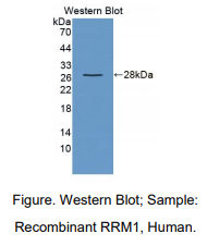 https://msimg.bioon.com/bionline/goods-no-pic.png