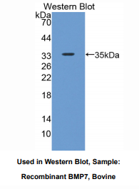 https://msimg.bioon.com/bionline/goods-no-pic.png