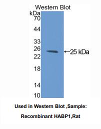 https://msimg.bioon.com/bionline/goods-no-pic.png