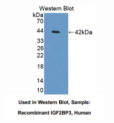 人胰岛素样生长因子2-mRNA结合蛋白3(IGF2BP3)多克隆抗体