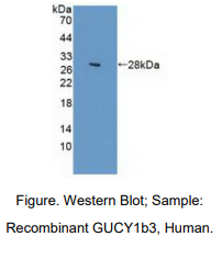 https://msimg.bioon.com/bionline/goods-no-pic.png