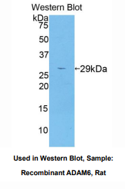 大鼠解整合素金属蛋白酶6(ADAM6)多克隆抗体