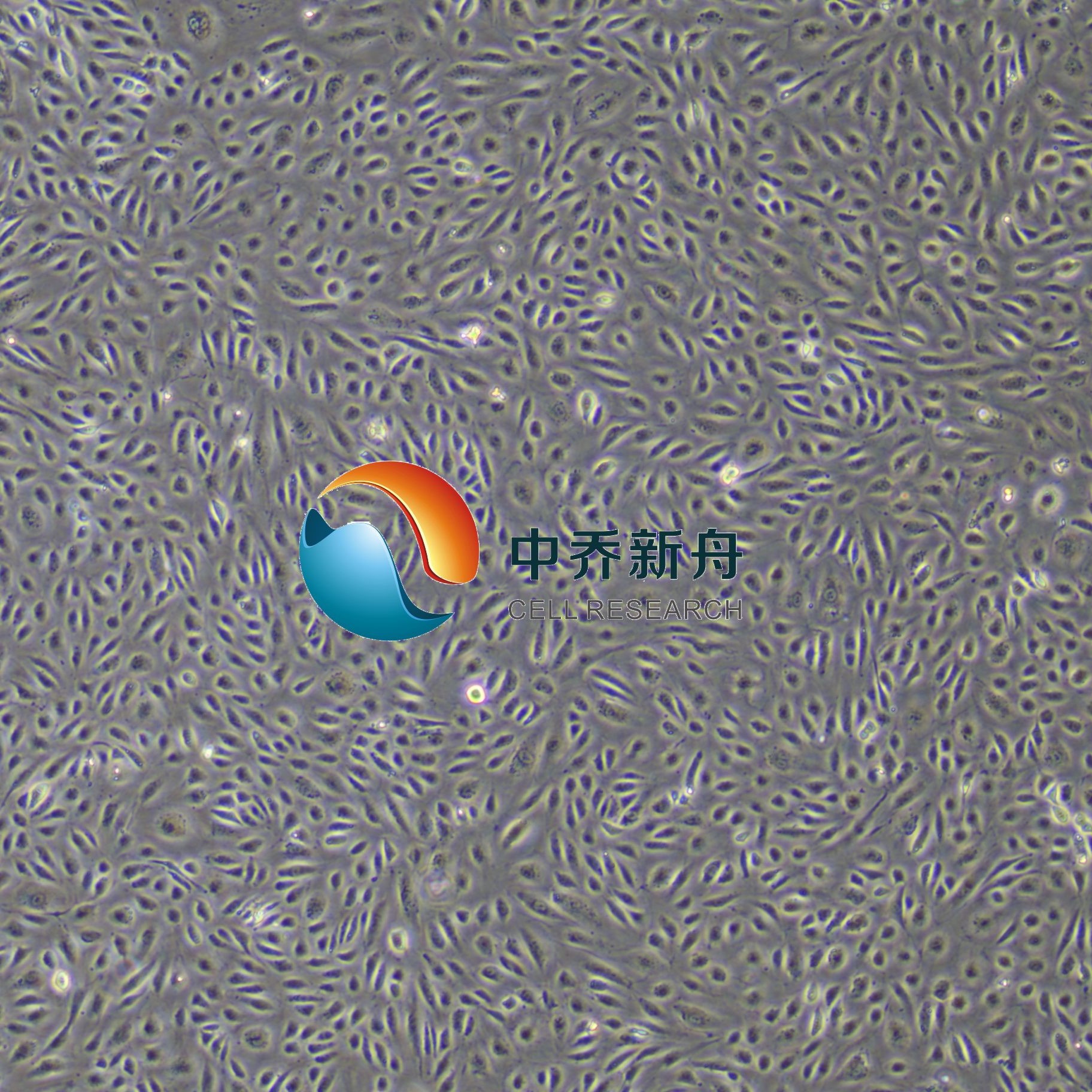 人肺动脉内皮细胞永生化