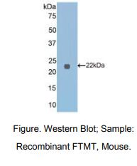 https://msimg.bioon.com/bionline/goods-no-pic.png