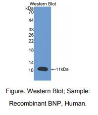 人脑钠素(BNP)多克隆抗体
