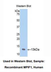 https://msimg.bioon.com/bionline/goods-no-pic.png