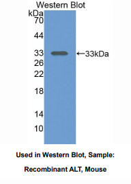 https://msimg.bioon.com/bionline/goods-no-pic.png