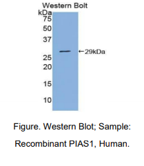 人激活STAT蛋白抑制因子1(PIAS1)多克隆抗体