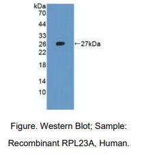 人核糖体蛋白L23A(RPL23A)多克隆抗体