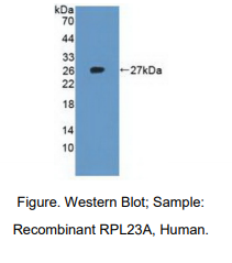 https://msimg.bioon.com/bionline/goods-no-pic.png