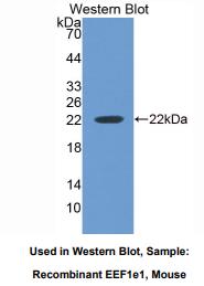 小鼠真核翻译延伸因子1ε1(EEF1e1)多克隆抗体