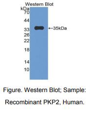 人血小板亲和蛋白2(PKP2)多克隆抗体
