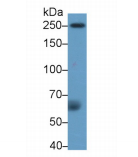 https://msimg.bioon.com/bionline/goods-no-pic.png