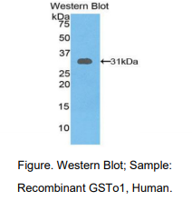 人谷胱甘肽S转移酶ω1(GSTo1)多克隆抗体