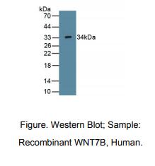 https://msimg.bioon.com/bionline/goods-no-pic.png