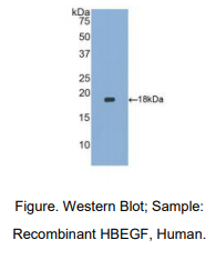 https://msimg.bioon.com/bionline/goods-no-pic.png