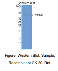 https://msimg.bioon.com/bionline/goods-no-pic.png