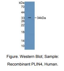 https://msimg.bioon.com/bionline/goods-no-pic.png