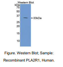 https://msimg.bioon.com/bionline/goods-no-pic.png