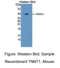 https://msimg.bioon.com/bionline/goods-no-pic.png