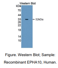 人肝配蛋白A受体10(EPHA10)多克隆抗体