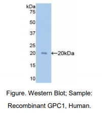 https://msimg.bioon.com/bionline/goods-no-pic.png