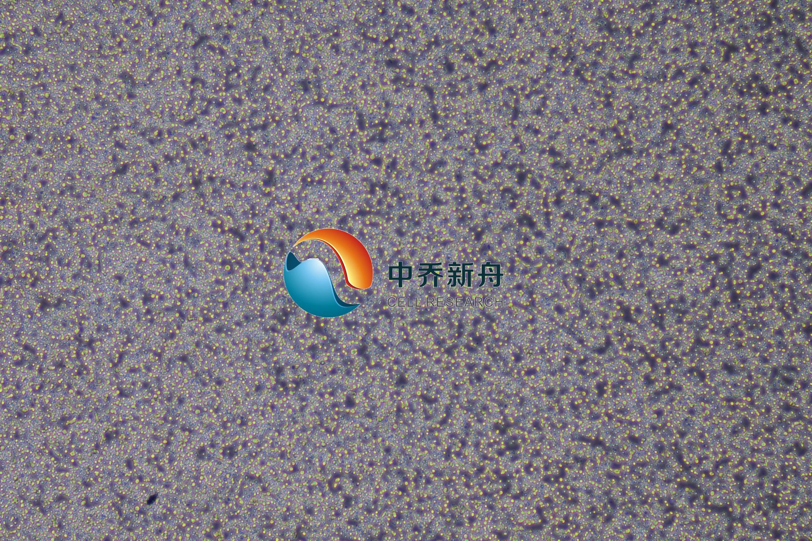 MM.1R人多发性骨髓瘤细胞