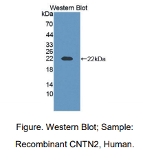 https://msimg.bioon.com/bionline/goods-no-pic.png