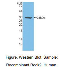 https://msimg.bioon.com/bionline/goods-no-pic.png