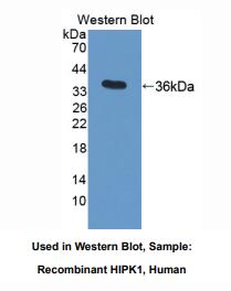 https://msimg.bioon.com/bionline/goods-no-pic.png