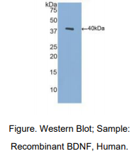 人脑源性神经营养因子(BDNF)多克隆抗体