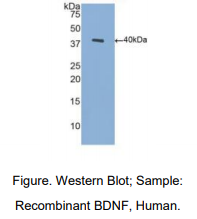 https://msimg.bioon.com/bionline/goods-no-pic.png