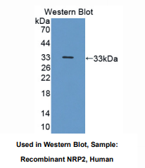 https://msimg.bioon.com/bionline/goods-no-pic.png