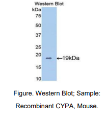 https://msimg.bioon.com/bionline/goods-no-pic.png