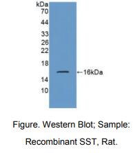 大鼠生长抑素(SST)多克隆抗体