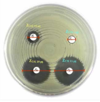 https://img.medsci.cn/a153e50aaab88627e141f44fc1db1a504d4e5bb08eafa6e013bea961dcc7ad69.jpg