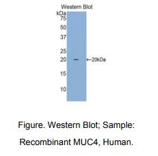 https://msimg.bioon.com/bionline/goods-no-pic.png