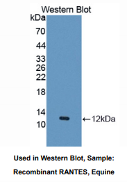 https://msimg.bioon.com/bionline/goods-no-pic.png