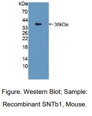 小鼠互生蛋白β1(SNTb1)多克隆抗体