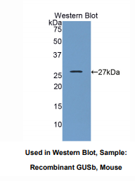 https://msimg.bioon.com/bionline/goods-no-pic.png