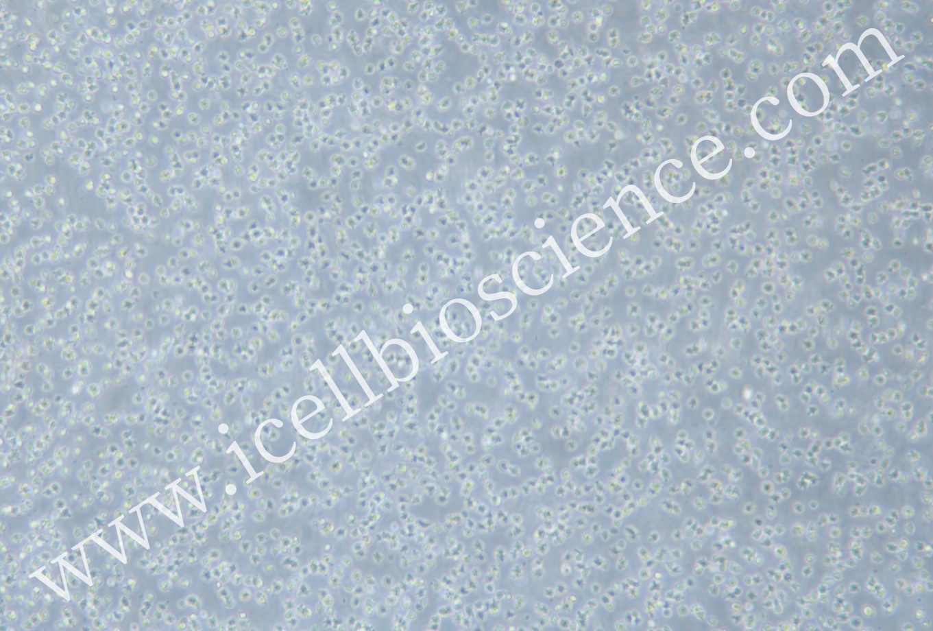 OCI-LY1细胞/OCILY1细胞/OCI-LY1/OCILY1/人B细胞淋巴瘤细胞