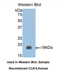 https://msimg.bioon.com/bionline/goods-no-pic.png