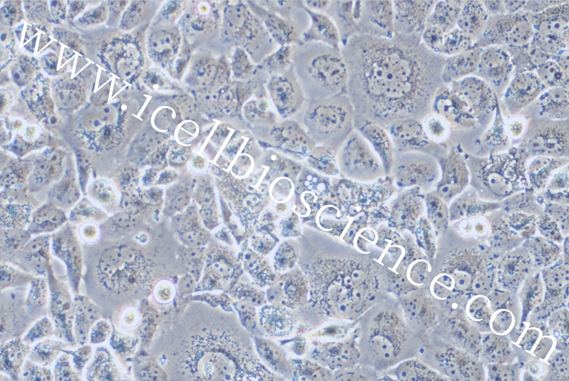 TTA-1细胞/TTA1细胞/TTA-1/TTA1/人甲状腺癌细胞（未分化）