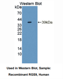 https://msimg.bioon.com/bionline/goods-no-pic.png