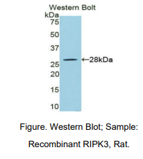 https://msimg.bioon.com/bionline/goods-no-pic.png