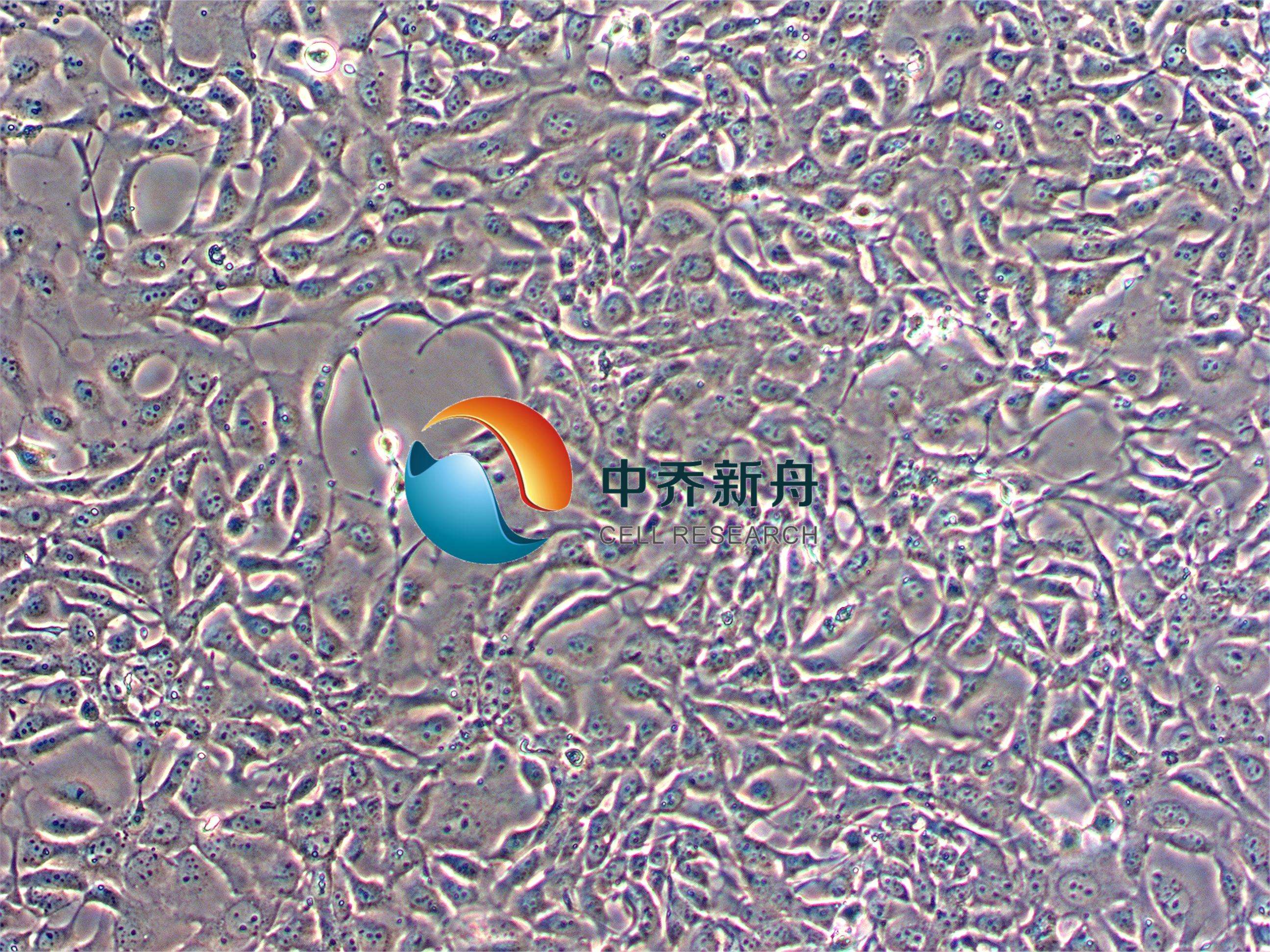 人食管鳞癌细胞