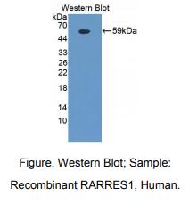 人维甲酸受体应答基因1(RARRES1)多克隆抗体