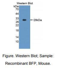 https://msimg.bioon.com/bionline/goods-no-pic.png