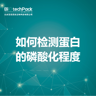 https://msimg.bioon.com/bionline/goods-no-pic.png