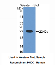 https://msimg.bioon.com/bionline/goods-no-pic.png